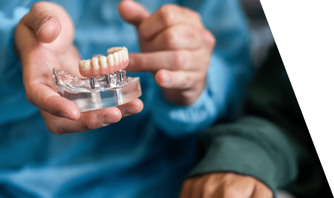 Traitements prothese dentaire sur implants Drs Dard et Cannet